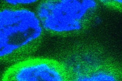 Human cells expressing inflammatory cytokines (stained green)